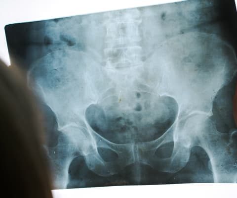 Foto-Radiologia
